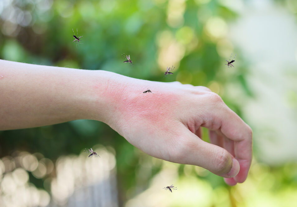 Mosquitoes bite on adult hand made skin rash and allergy with red spot
